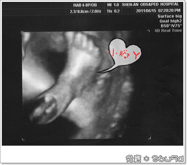 baby-26w5d-1.jpg