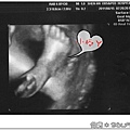 baby-26w5d-1.jpg