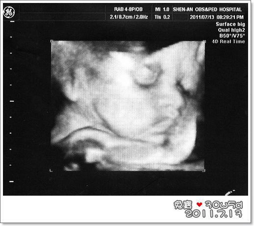 baby-30w5d.jpg