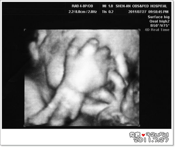 baby-32w5d.jpg baby-32w5d.jpg