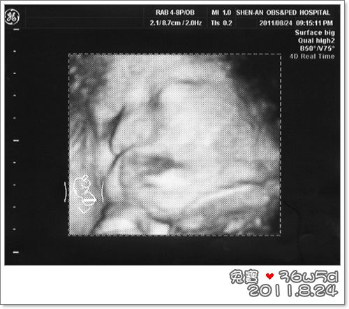 baby-36w5d.jpg