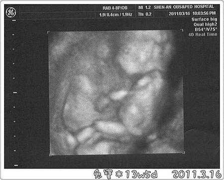 baby-13w5d.jpg baby-13w5d.jpg