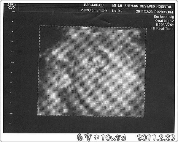 baby-10w5d.jpg