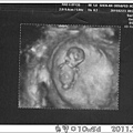 baby-10w5d.jpg