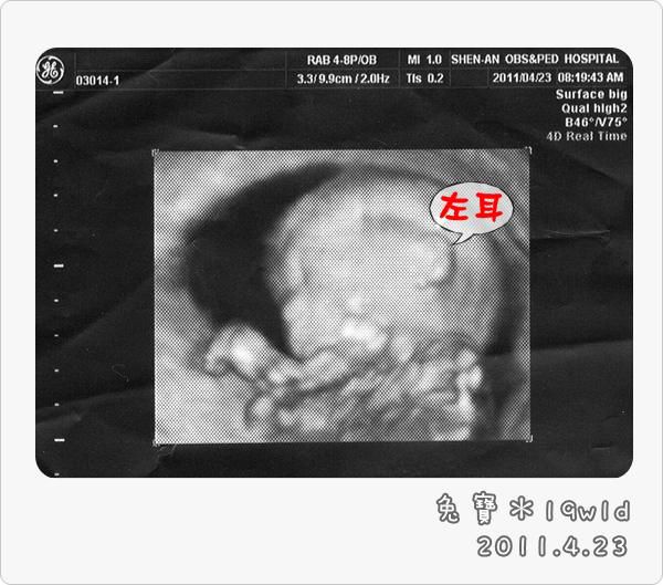 baby-19w1d.jpg