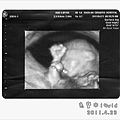 baby-19w1d-1.jpg