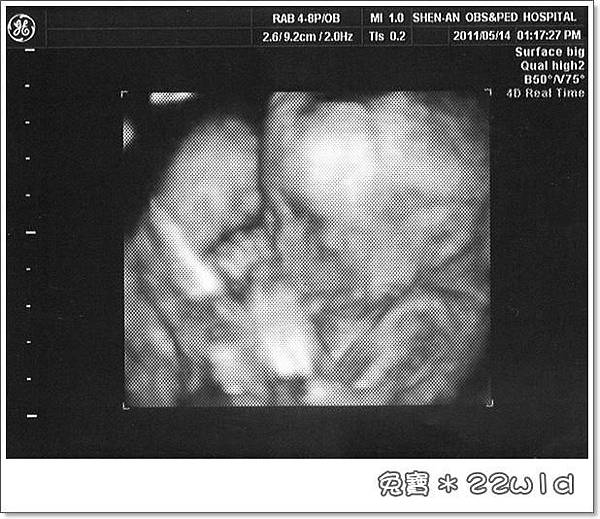 baby-22w1d-1.jpg baby-22w1d-1.jpg