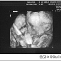 baby-22w1d-1.jpg