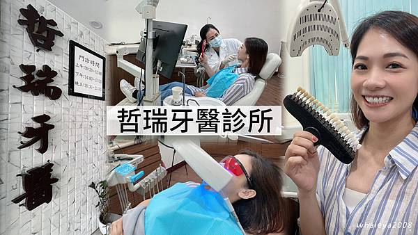 牙齒顏色不均好困擾？牙齒美白會傷牙齒嗎？【哲瑞牙醫診所】全程