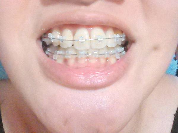 2015-07-02-20-47-00_photo