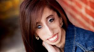 「Lizzie Velasquez」的圖片搜尋結果