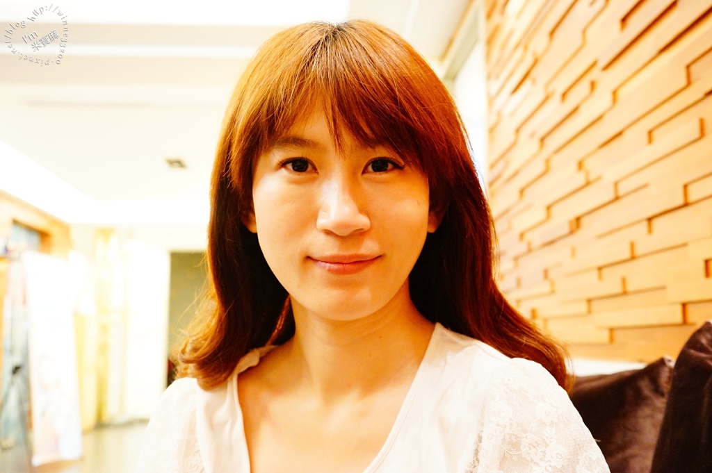 悠美診所肉毒小臉_4 悠美診所肉毒小臉_4