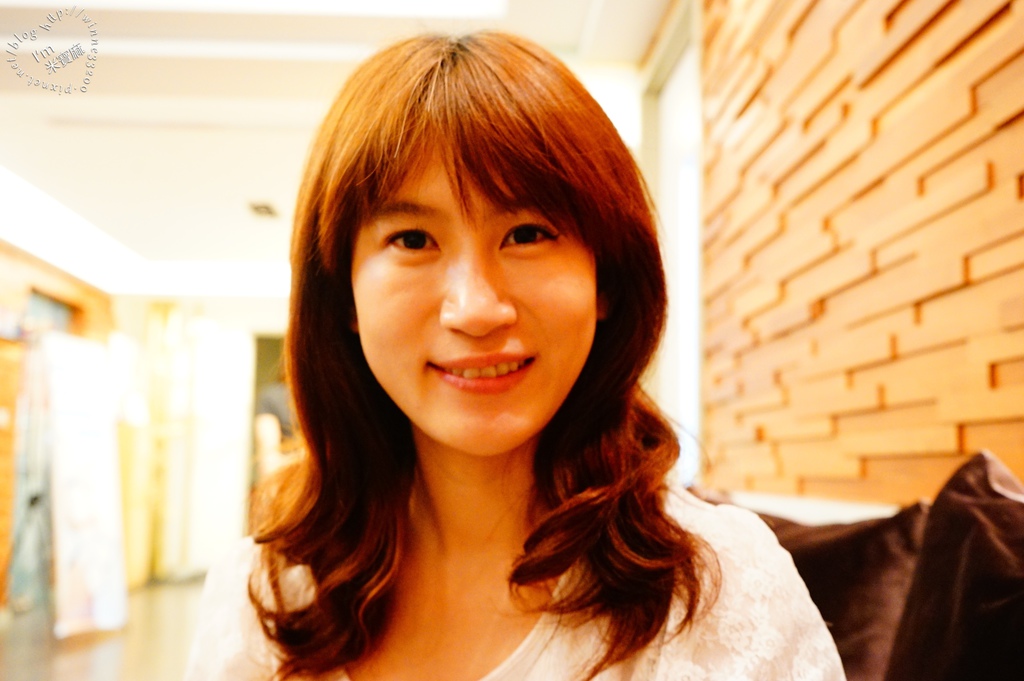 悠美診所肉毒小臉_5 悠美診所肉毒小臉_5