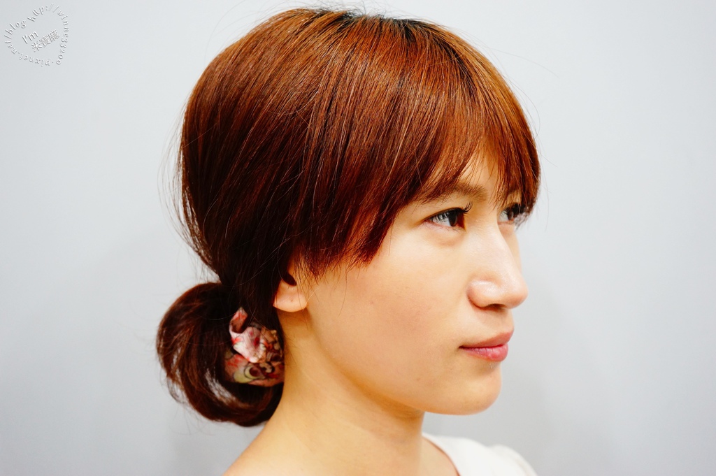 悠美診所肉毒小臉_1 悠美診所肉毒小臉_1