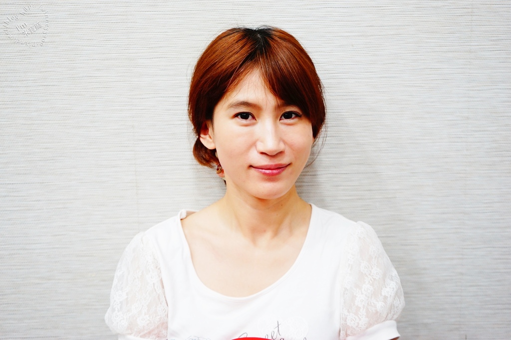 悠美診所肉毒小臉_11 悠美診所肉毒小臉_11