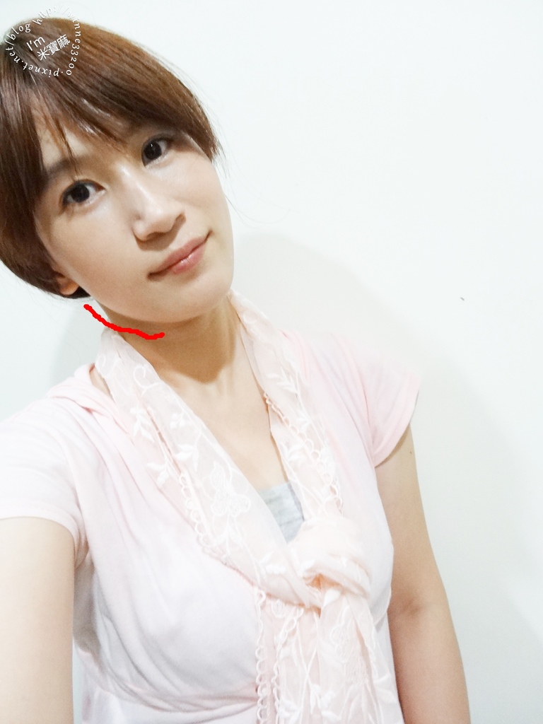 悠美診所肉毒小臉_21 悠美診所肉毒小臉_21
