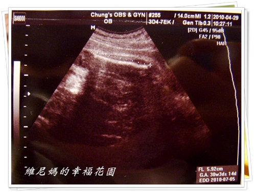 第六次產檢超音波照片 (1).JPG