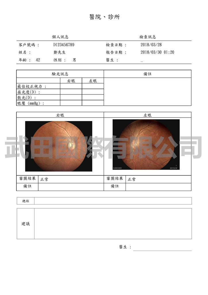 DEC200 眼底攝影機(人體葉黃素及黃斑部病變檢測儀)-人體葉黃素報告及黃斑部病變報告-5.jpg