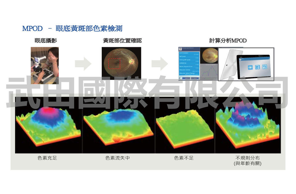 DEC200 眼底攝影機(人體葉黃素及黃斑部病變檢測儀)-人體葉黃素報告及黃斑部病變報告-3.jpg