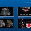 全新、中古(二手)GE LOGIQ P9 超音波掃描儀(落地型)(腹部、頸動脈、骨骼肌肉關節)_頁面_3.jpg