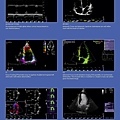 全新、中古(二手)GE Vivid S6 Brochure心臟超音波掃描儀(落地型)(心臟、腹部、頸動脈、骨骼肌肉關節)_頁面_05.jpg