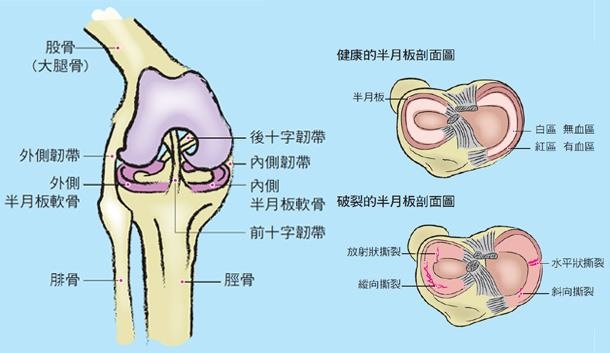 半月軟骨關節鏡術後2個月的運動復健 女人我最大 就是要健康美麗 痞客邦