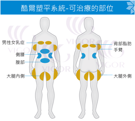 冷凍溶脂治療部位