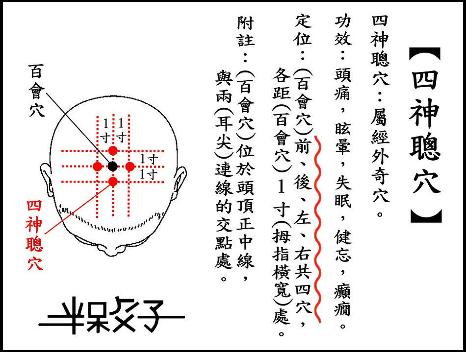 ●四神聰穴(頭).jpg ●四神聰穴(頭).jpg