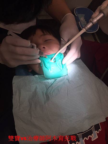 ﹝育儿医疗﹞虾米!4岁的小孩蛀牙要抽神经~儿