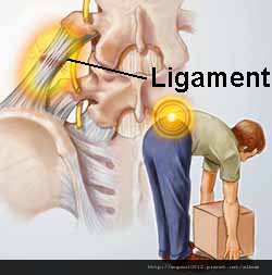 Lumbar Back Sprains and Strains