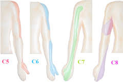 C5-C8 神經壓迫