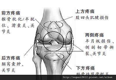 膝蓋痛 了解疼痛的真相 謎 真相永遠只有一個 吳岳物理治療所 痞客邦