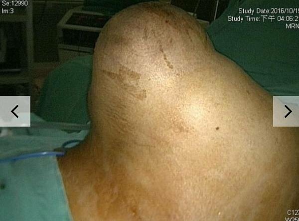 ventral H BIG.jpg ventral H BIG.jpg