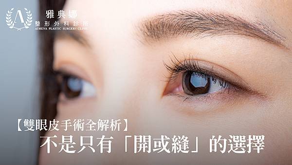 【雙眼皮手術全解析】不是只有「開或縫」的選擇——從設計、條件