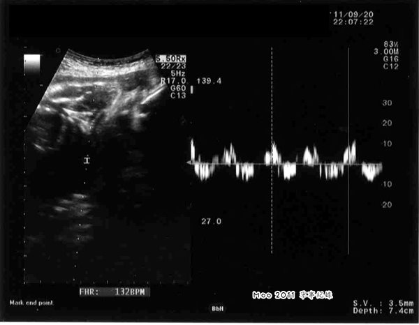 小小手超音波記錄-0920-2