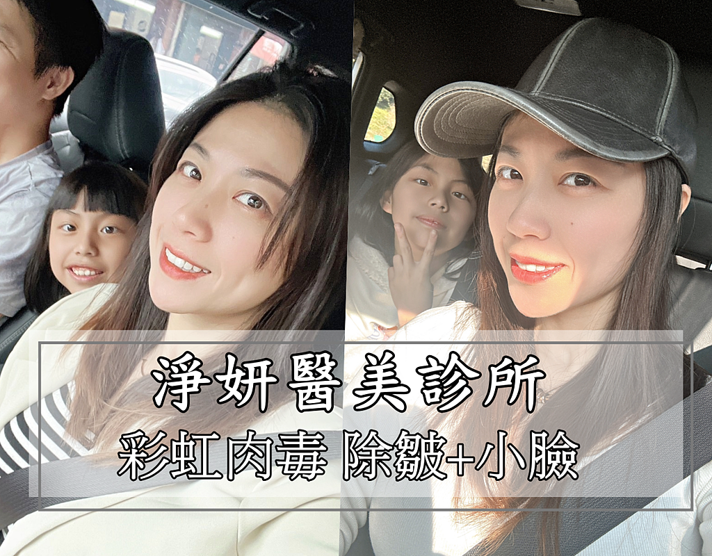 |醫美心得| 淨妍醫美診所 彩虹肉毒抬頭紋+小臉 立即有感!