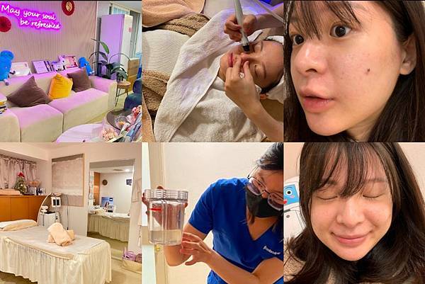 台北東區 沐凈診所 童顏水飛梭心得分享 兩小時清光毛孔髒污! 台北東區 沐凈診所 童顏水飛梭心得分享 兩小時清光毛孔髒污!