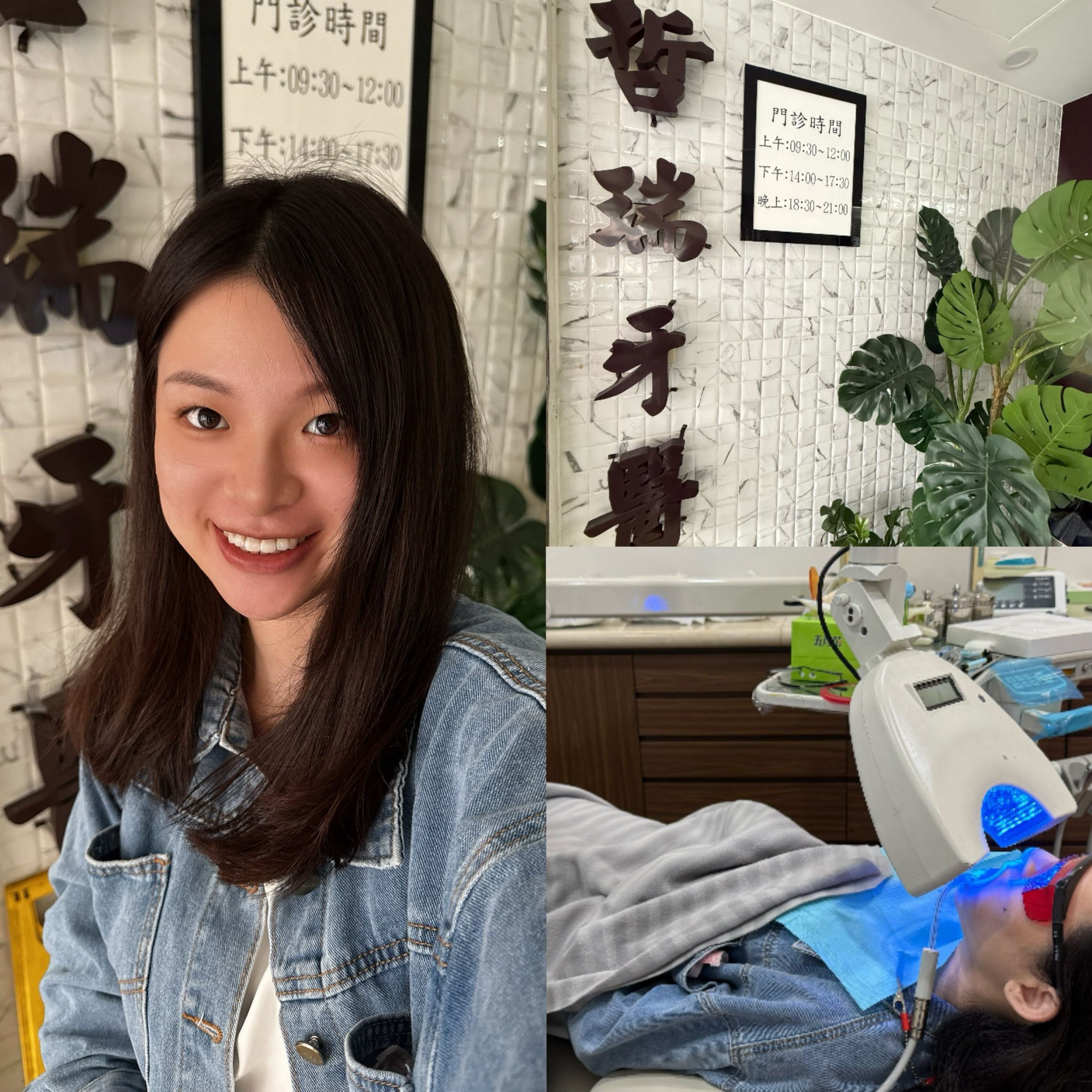 專業牙齒美白推薦 士林哲瑞牙醫冷光美白初體驗 找回自信笑容 專業牙齒美白推薦 士林哲瑞牙醫冷光美白初體驗 找回自信笑容