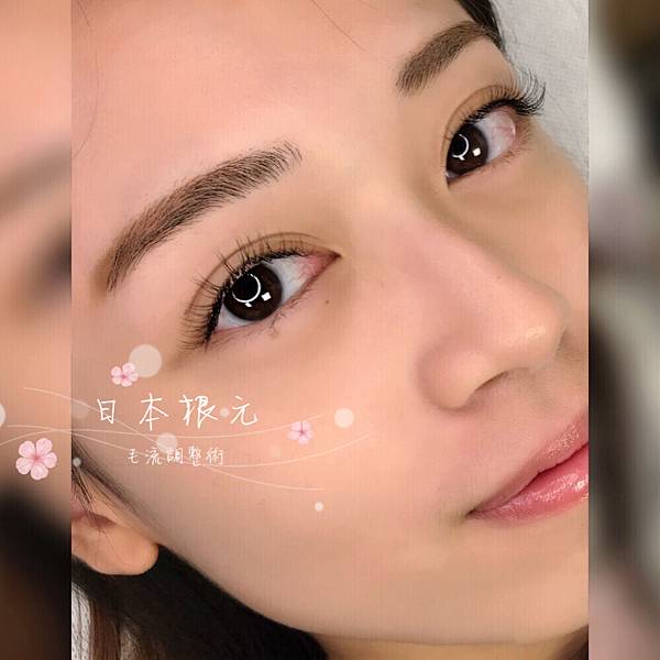 日本根元毛流矯正術 琟美主義日式美學 痞客邦 日本根元毛流矯正術 琟美主義日式美學 痞客邦