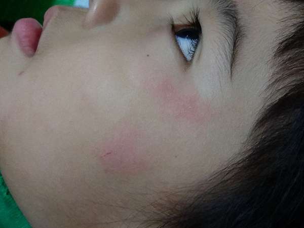 控制不了的癲癇 一 莎蕥 精彩過生活 痞客邦