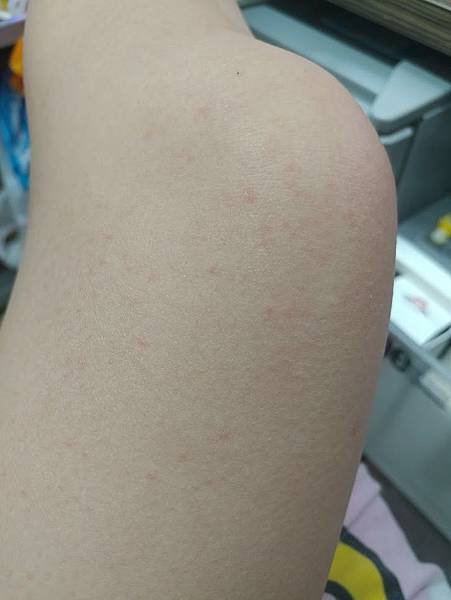 20170410_012603 試用