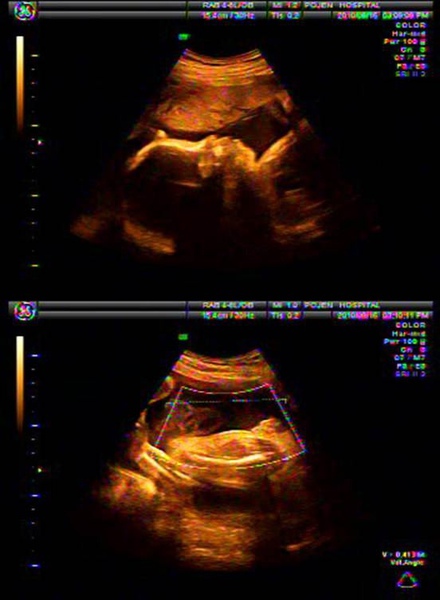 在肚子裡的模樣