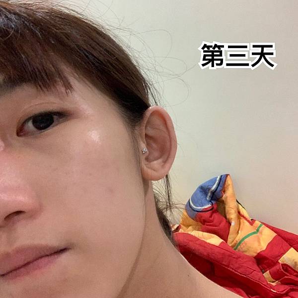 VICHY薇姿15%維他命C超導安瓶,安瓶推薦,維他命C,加強提亮