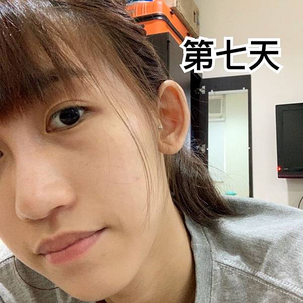 VICHY薇姿15%維他命C超導安瓶,安瓶推薦,維他命C,加強提亮