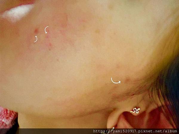 女人知己試用大隊,口碑行銷,部落客行銷,babywhite美白精華,babywhite精華評價,babywhite7大問題精華,配方有保濕基礎,吸收超快,開架保濕推薦,好用精華液,妝前保養推薦,台灣保養品推薦