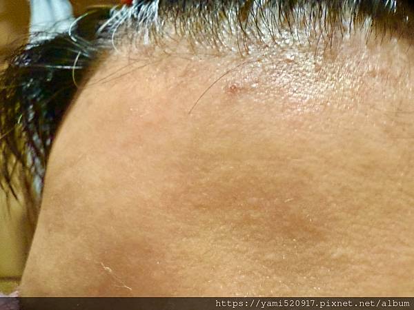 BABYWHITE-Baby抗痘精華