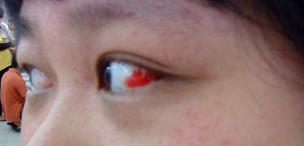 my eye.jpg