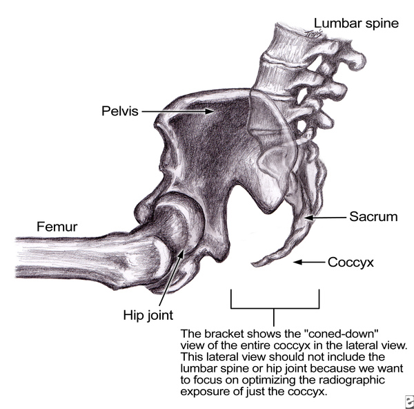 coccyx3.jpg