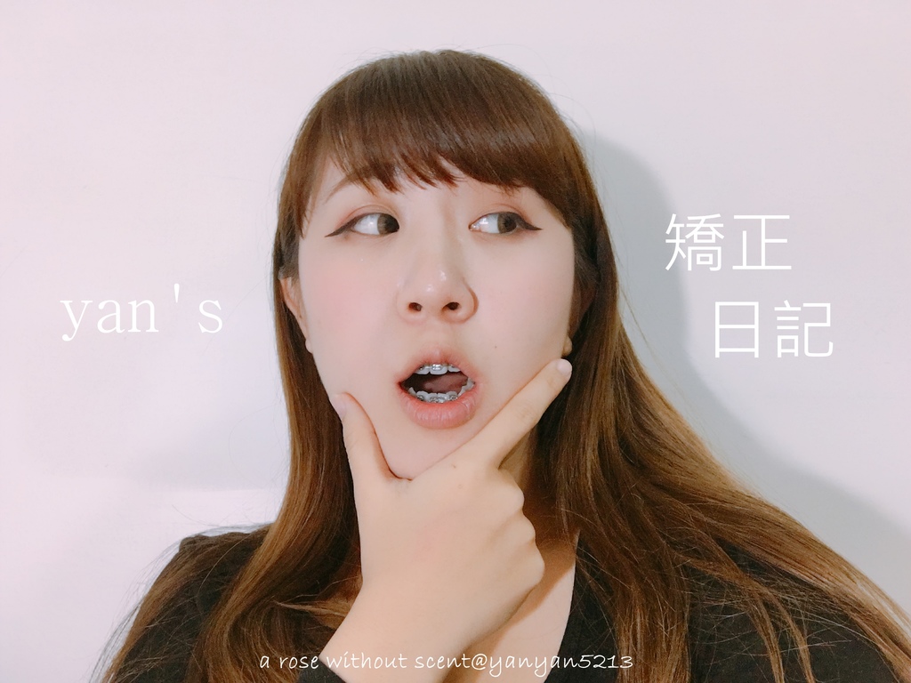 IMG_3660.JPG 矯正器