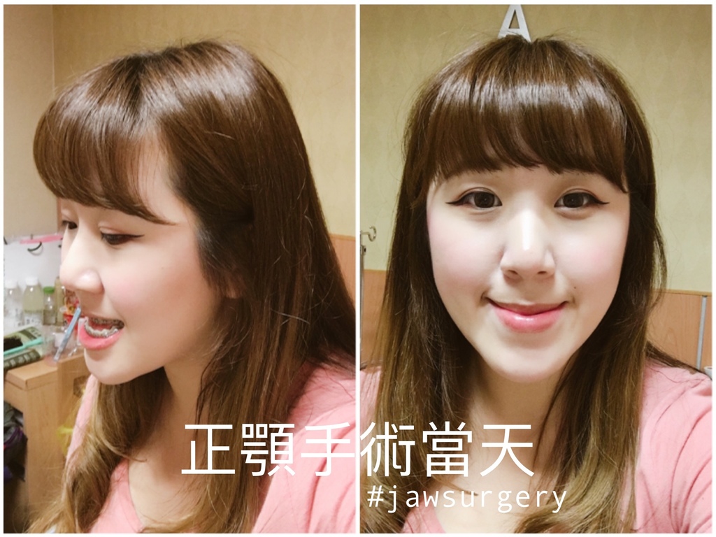 術